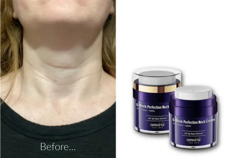 We tried the DefenAge Neck Perfecting Cream system for 6 weeks to see if it worked...