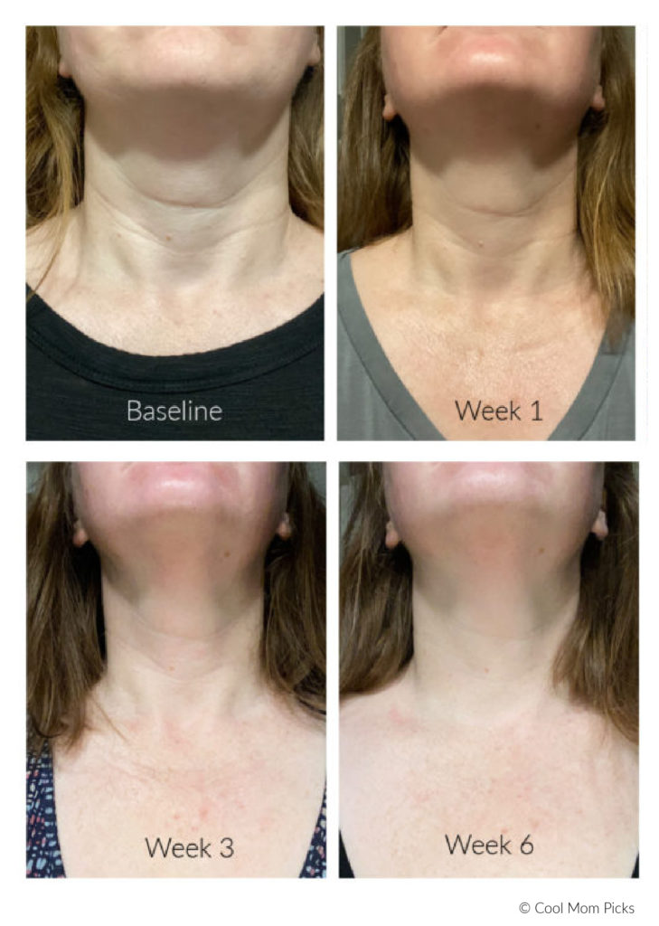 Trying DefenAge 6 Week Neck Perfecting Cream: Before and after photos. Whoa | Full review: Cool Mom Picks