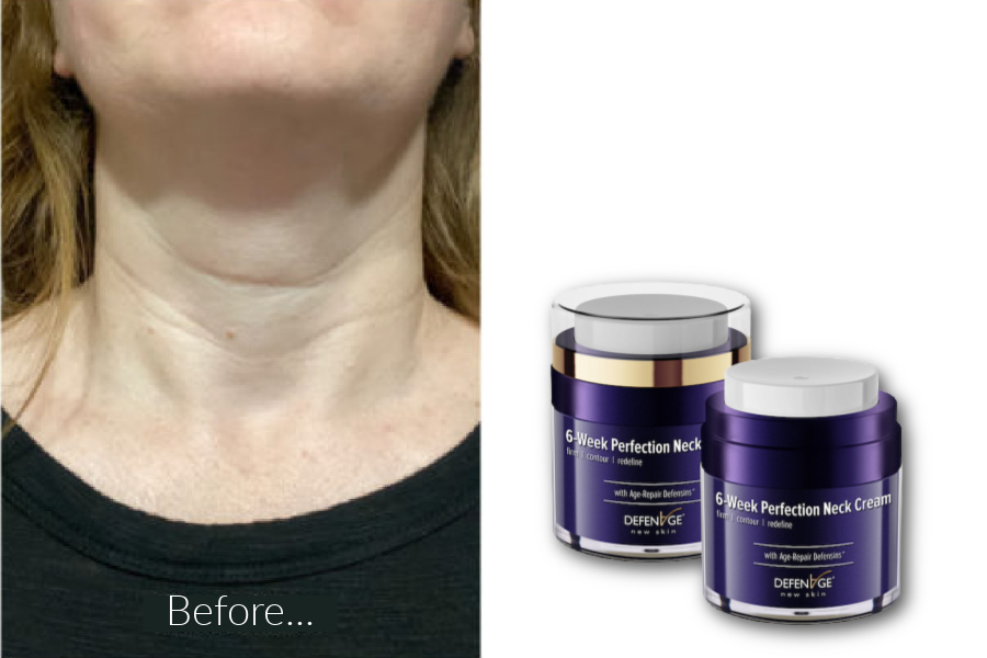Does DefenAge 6-week Perfection Neck Tightening Cream really perfect your neck? Here are my before and after photos.